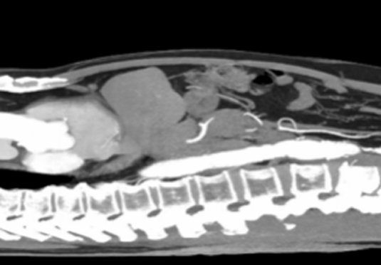 除外恶液质晚期